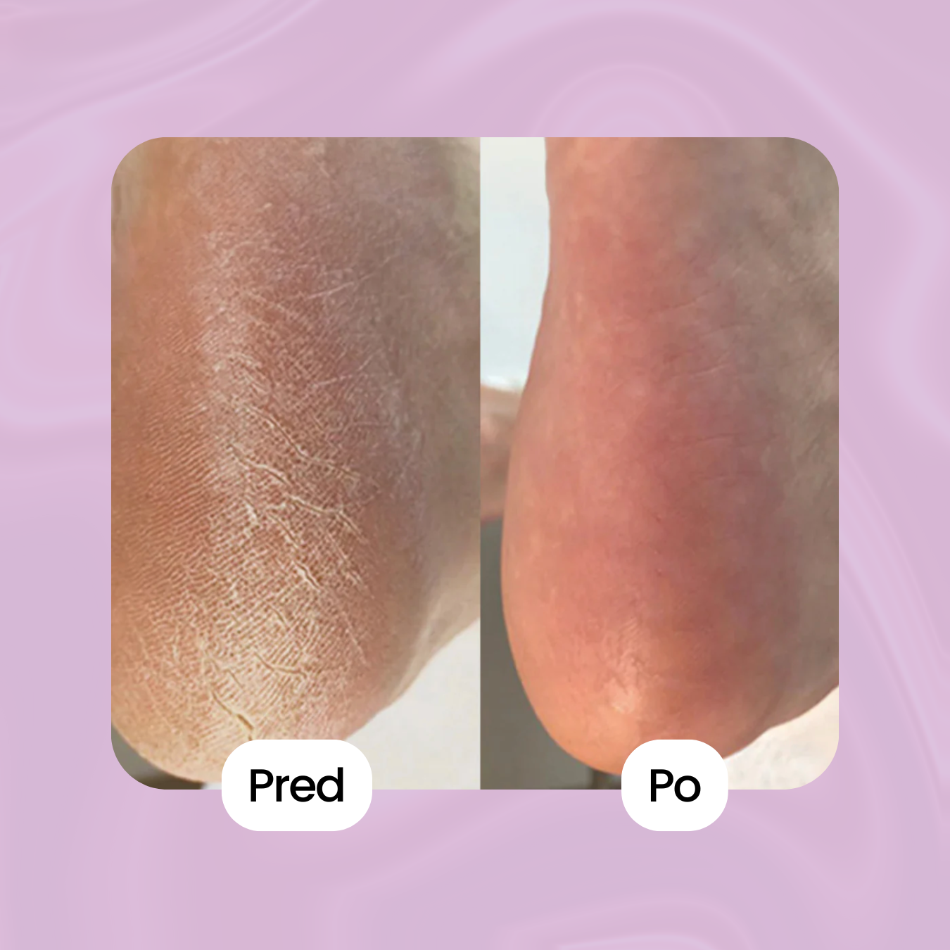 ShinyWay - Silky Touch 2.0