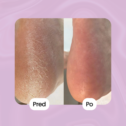 ShinyWay - Silky Touch 2.0